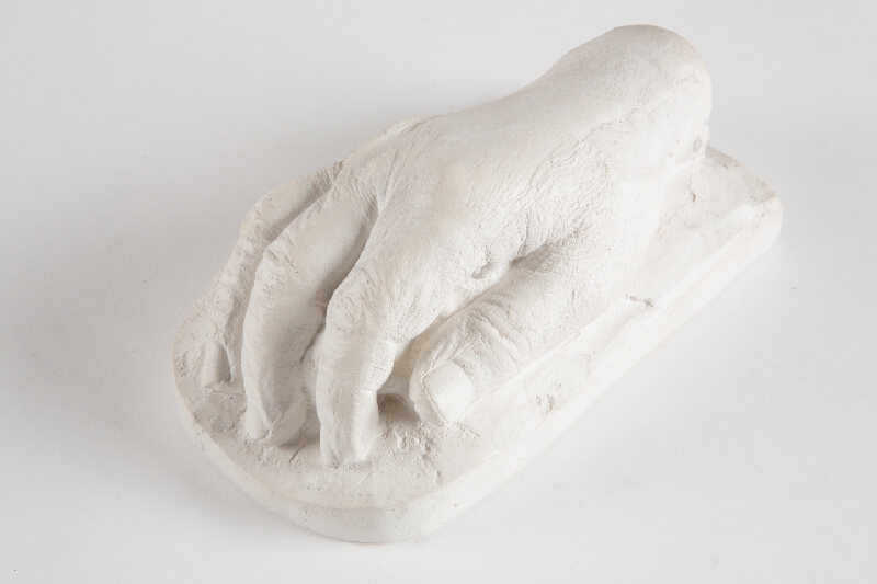 Neznámy autor – Posmrtná maska a pravá ruka zaslúžilého umelca profesora Petra Matejku 