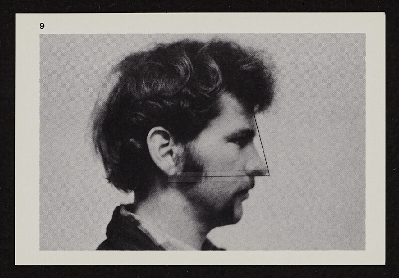 Richards Jarden – Facial Angle 