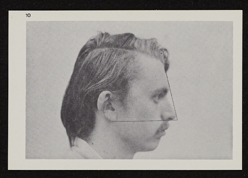 Richards Jarden – Facial Angle 