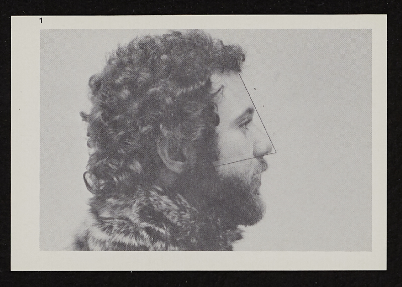 Richards Jarden – Facial Angle 