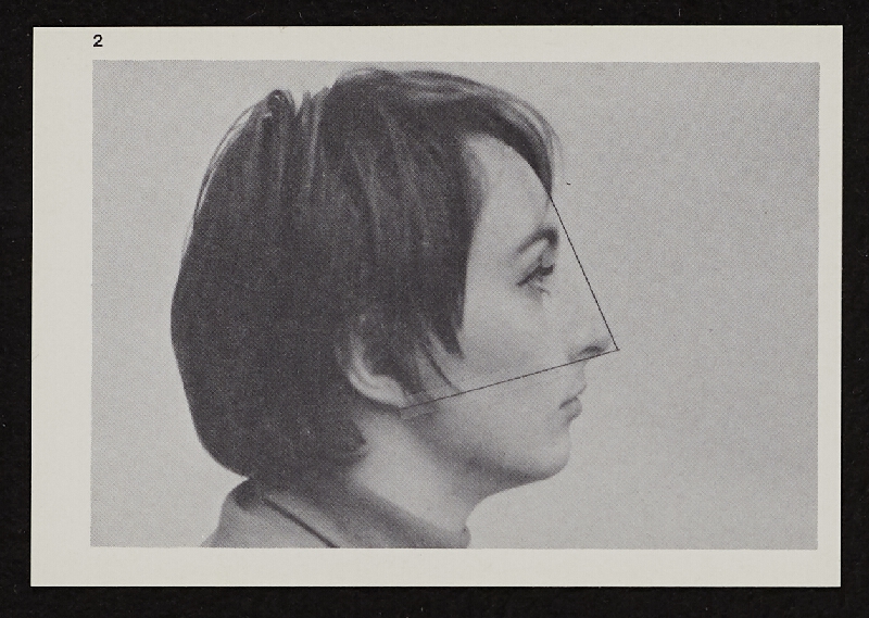 Richards Jarden – Facial Angle 