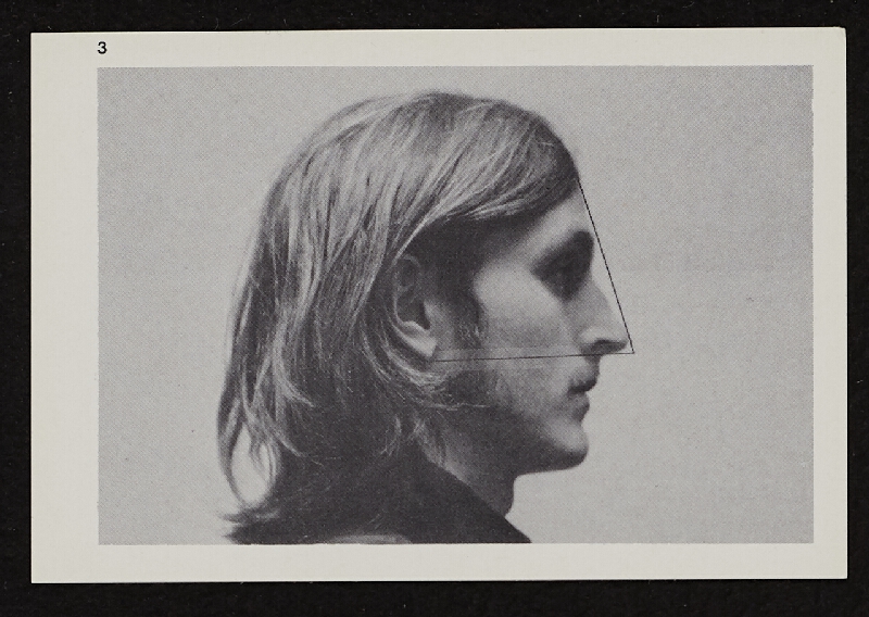 Richards Jarden – Facial Angle 