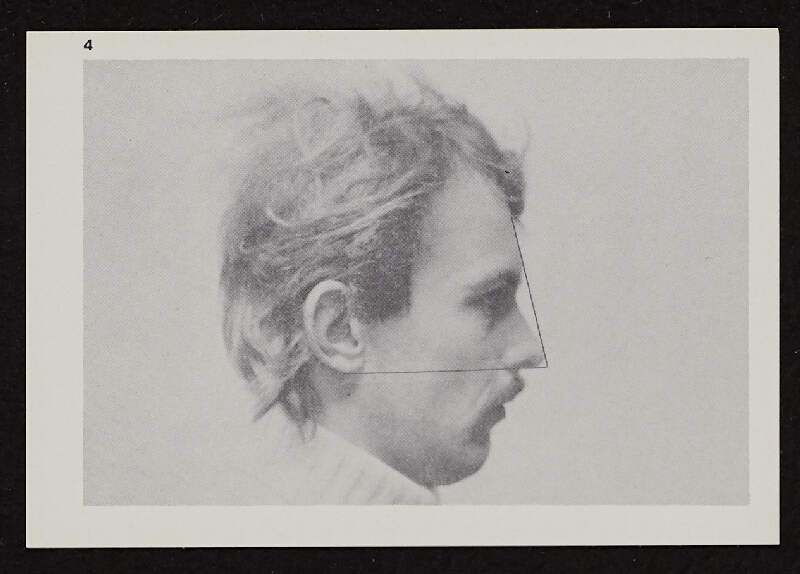 Richards Jarden – Facial Angle 