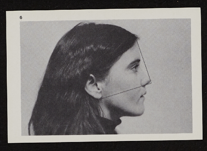 Richards Jarden – Facial Angle 