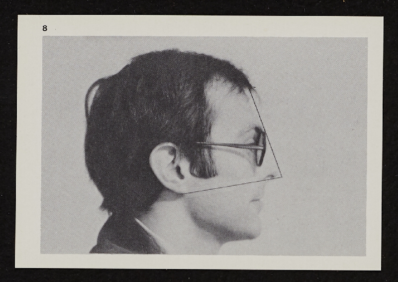 Richards Jarden – Facial Angle 