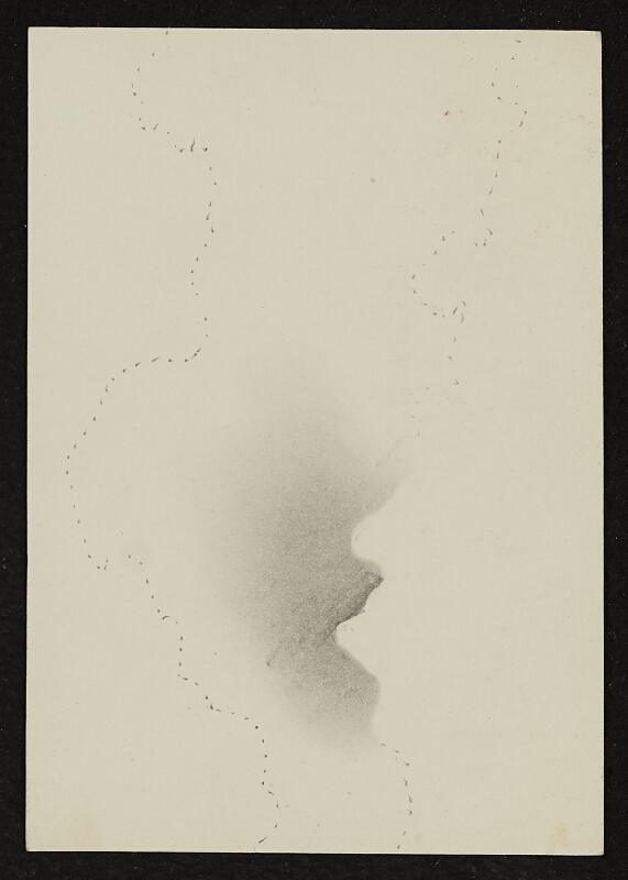 Dalibor Chatrný – Pozdrav z oční léčebny Nový Smokovec z 19.7.1979 